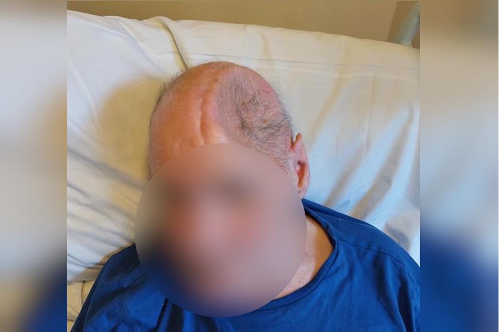 Serious collision leaves man with head injury